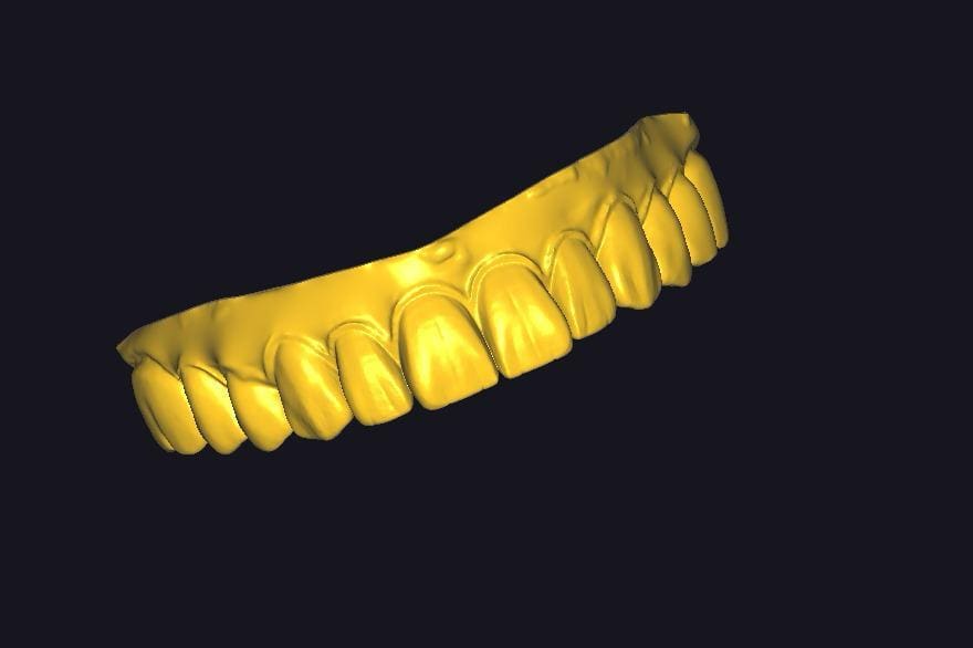 3D CAD CAM Teknolojisi
